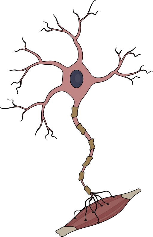 Damaged motor neuron